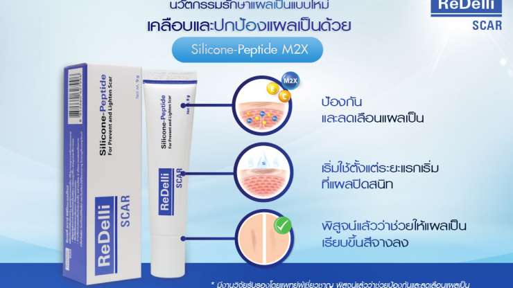 เจาะลึกหัวใจสำคัญ “ReDelli Scar” ทำให้แผลนุ่มจาง และลดเลือนแผลเป็น